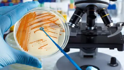 Microbiological Testing Services in Pune