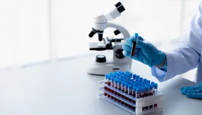 Laboratory Quality Assurance System Implementation
